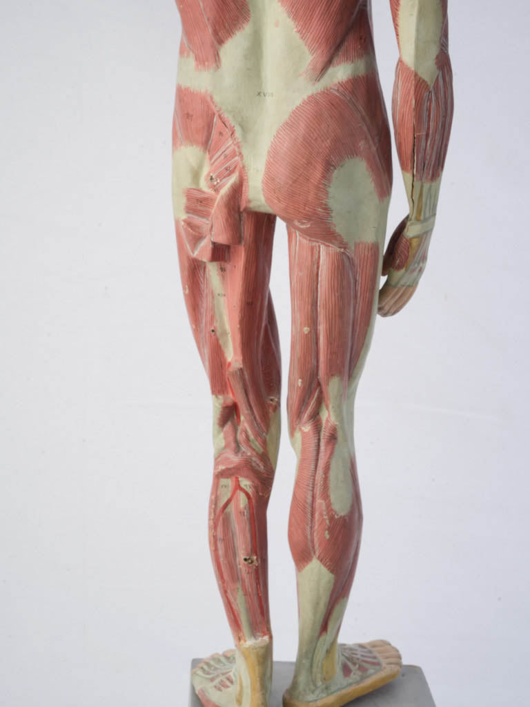 Missing elements realism sculpture